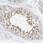 ARHGAP28 Antibody in Immunohistochemistry (Paraffin) (IHC (P))