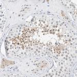 ARHGAP28 Polyclonal Antibody