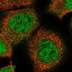 ZBTB48 Polyclonal Antibody