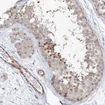 ZBTB48 Antibody in Immunohistochemistry (Paraffin) (IHC (P))