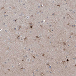 ZBTB48 Antibody in Immunohistochemistry (Paraffin) (IHC (P))