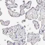 MRPS33 Antibody in Immunohistochemistry (Paraffin) (IHC (P))