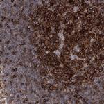 FAM167A Antibody in Immunohistochemistry (Paraffin) (IHC (P))