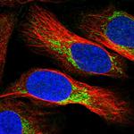 NDUFV3 Polyclonal Antibody