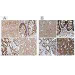 NDUFV3 Antibody in Immunohistochemistry (IHC)