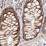 NDUFV3 Antibody in Immunohistochemistry (IHC)