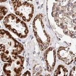 NDUFV3 Antibody in Immunohistochemistry (IHC)