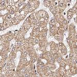 NDUFV3 Antibody in Immunohistochemistry (IHC)