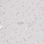 SLC35D3 Antibody in Immunohistochemistry (IHC)