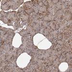 MICAL2 Polyclonal Antibody