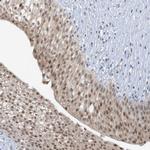 UBE2E1 Polyclonal Antibody