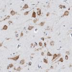 RPL26 Antibody in Immunohistochemistry (Paraffin) (IHC (P))
