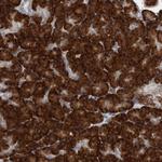 RPL26 Antibody in Immunohistochemistry (Paraffin) (IHC (P))
