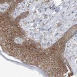 RPL26 Antibody in Immunohistochemistry (Paraffin) (IHC (P))