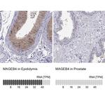 MAGEB4 Polyclonal Antibody