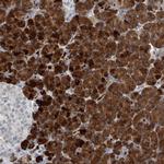 KCNK10 Polyclonal Antibody