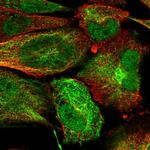 KIAA0247 Antibody in Immunocytochemistry (ICC/IF)