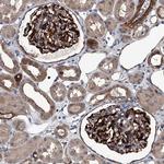 LDLRAD2 Polyclonal Antibody