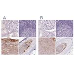 RPTN Polyclonal Antibody