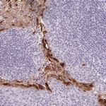 RPTN Antibody in Immunohistochemistry (IHC)