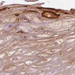 RPTN Antibody in Immunohistochemistry (IHC)