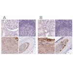 RPTN Polyclonal Antibody