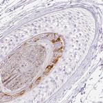 RPTN Antibody in Immunohistochemistry (IHC)