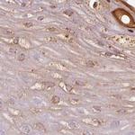 RPTN Antibody in Immunohistochemistry (IHC)