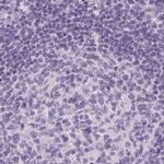 RPTN Antibody in Immunohistochemistry (IHC)