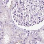 RPTN Antibody in Immunohistochemistry (IHC)