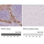 RPTN Antibody