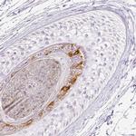 RPTN Antibody in Immunohistochemistry (IHC)