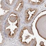 SLC39A2 Polyclonal Antibody