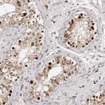 KLF7 Antibody in Immunohistochemistry (IHC)