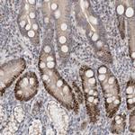 KLF7 Antibody in Immunohistochemistry (IHC)