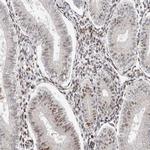 KLF7 Antibody in Immunohistochemistry (IHC)