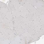 KLF7 Antibody in Immunohistochemistry (IHC)