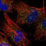 GYG1 Polyclonal Antibody