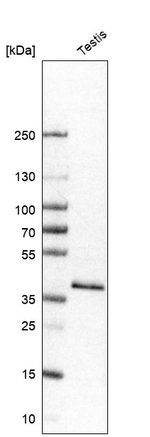 GYG1 Antibody in Western Blot (WB)