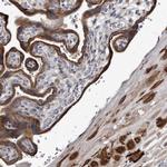 YPEL3 Polyclonal Antibody