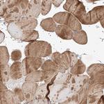 TSR2 Antibody in Immunohistochemistry (IHC)