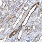 PIK3C2B Antibody in Immunohistochemistry (Paraffin) (IHC (P))