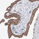 PIK3C2B Polyclonal Antibody