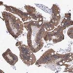 PIK3C2B Antibody in Immunohistochemistry (Paraffin) (IHC (P))