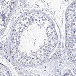 PIK3C2B Antibody in Immunohistochemistry (Paraffin) (IHC (P))