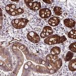 MARCKSL1 Antibody in Immunohistochemistry (Paraffin) (IHC (P))