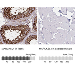 MARCKSL1 Antibody in Immunohistochemistry (Paraffin) (IHC (P))