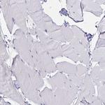 MARCKSL1 Antibody in Immunohistochemistry (Paraffin) (IHC (P))