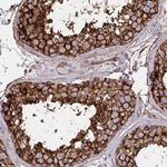 MARCKSL1 Antibody in Immunohistochemistry (Paraffin) (IHC (P))