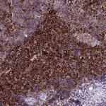 MARCKSL1 Antibody in Immunohistochemistry (Paraffin) (IHC (P))